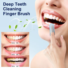 MySmile toallitas dientes eliminacion de manchas superficiales.