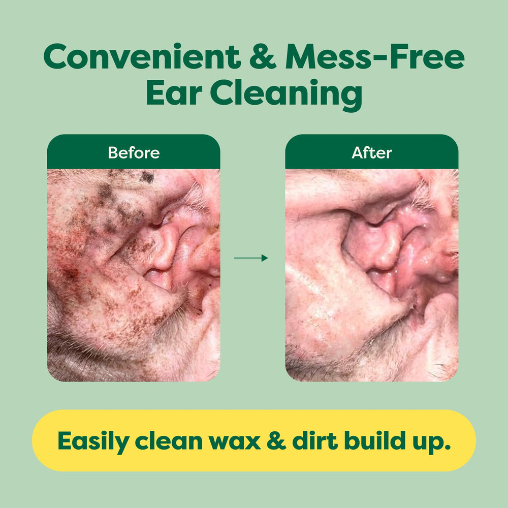 Earth Rated con aloe vera y manzanilla para piel sensible alrededor de orejas.