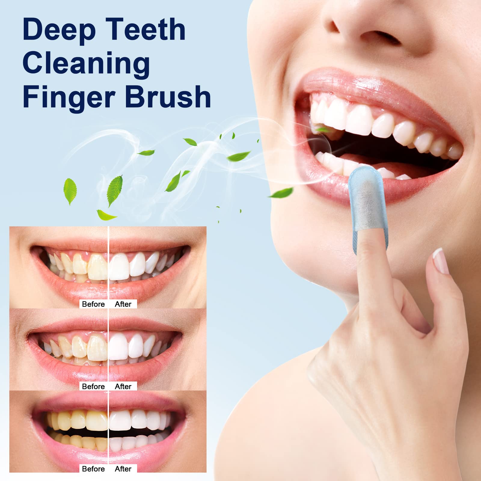 MySmile toallitas dientes eliminacion de manchas superficiales.