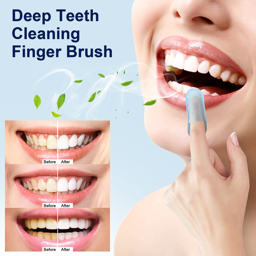 MySmile toallitas dientes eliminacion de manchas superficiales.