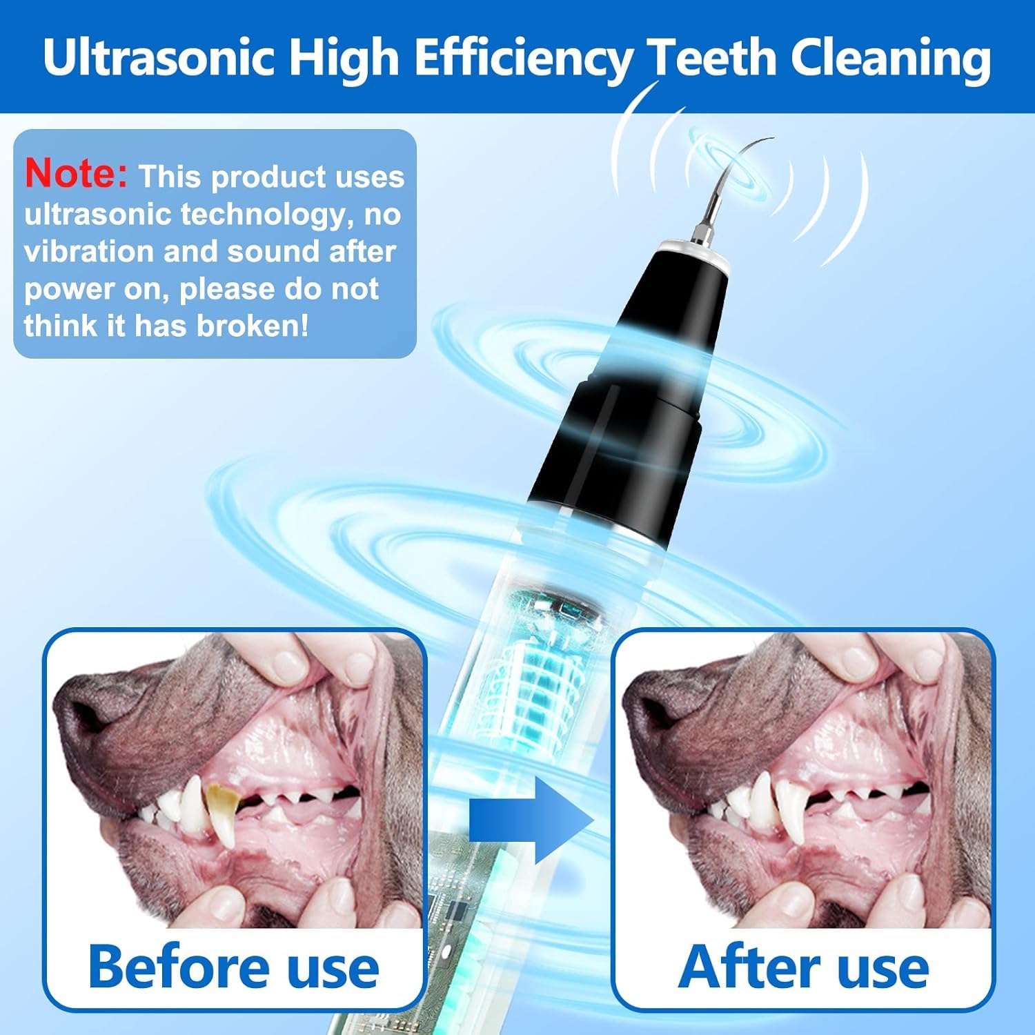 Kit profesional Ni-SHEN con herramientas dentales para el cuidado bucal