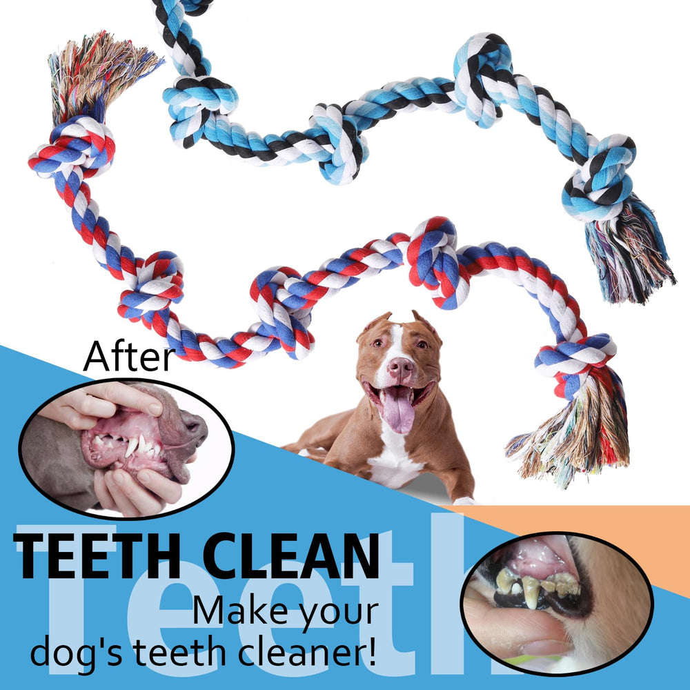 XIGOU juguete dental de cuerda, ayuda a limpieza suave de dientes.